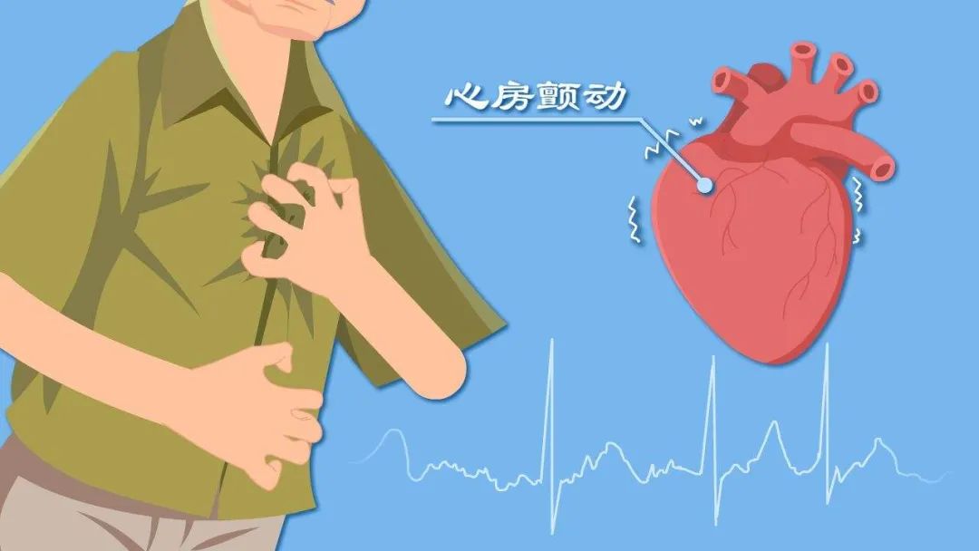 科普 | 關(guān)于房顫的你了解多少？快避開這些誤區(qū)！