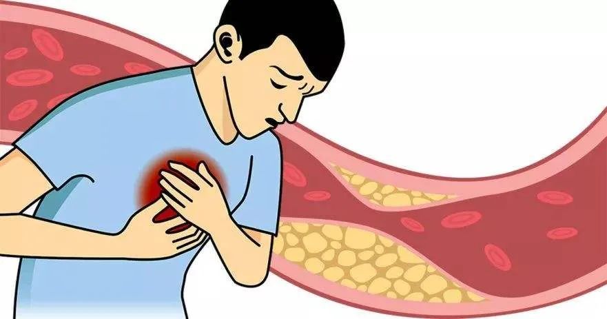 高膽固醇不能吃雞蛋？膽固醇也有“好壞”之分！