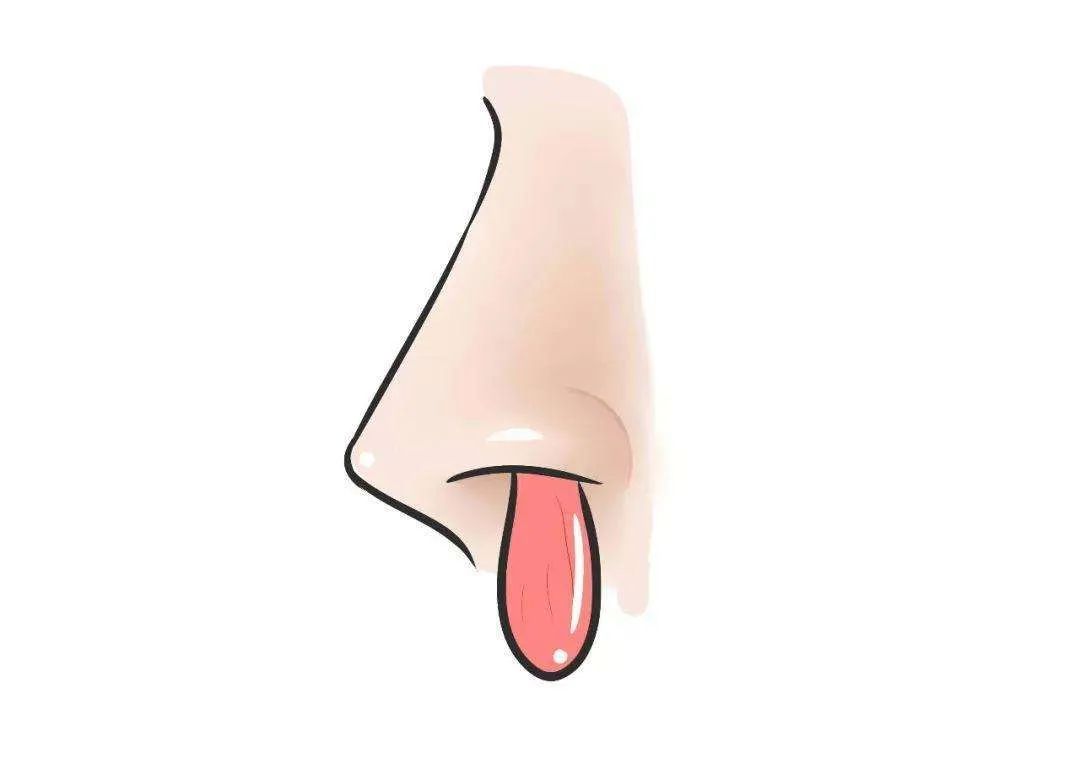 科普 | 鼻出血可不是小問題，科學(xué)治療最重要