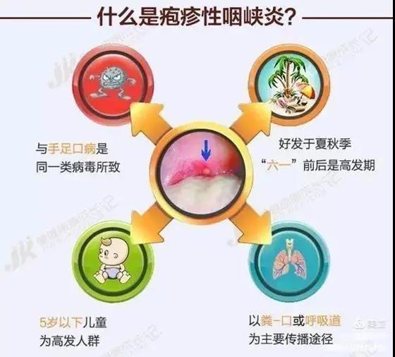 皰疹性咽峽炎及手足口病不用慌，紫外線燈來幫忙