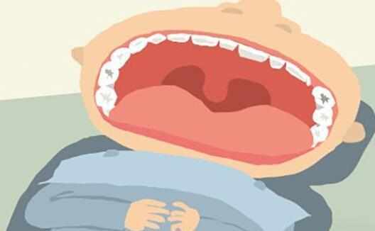 口苦口臭又磨牙”千萬別大意！這是胃向你發(fā)出的“求救信號”