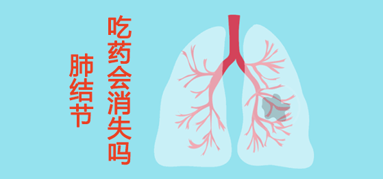 肺結(jié)節(jié)吃藥可以消失嗎？