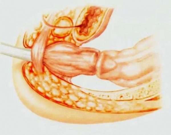6-tuya.jpg