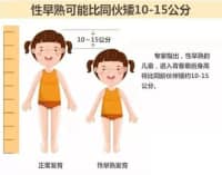 孩子長不高、性早熟，免費測骨齡來啦！骨齡儀免費檢測義診！