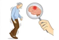 數(shù)九寒天，如何預(yù)防卒中發(fā)生？要牢記這5點……