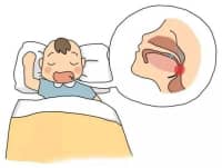 9歲男孩睡覺(jué)打鼾，醫(yī)生：嚴(yán)重會(huì)影響智力發(fā)育！