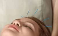秋季到，鼻炎鬧，得了鼻炎怎么辦？中醫(yī)：改善體質(zhì)是關(guān)鍵！