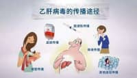 這種肝炎會傳染，治療沒選對會發(fā)展成肝癌！