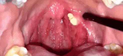 2.gif